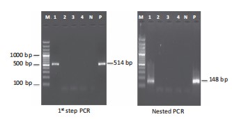 Phát hiện của EHP bằng PCR