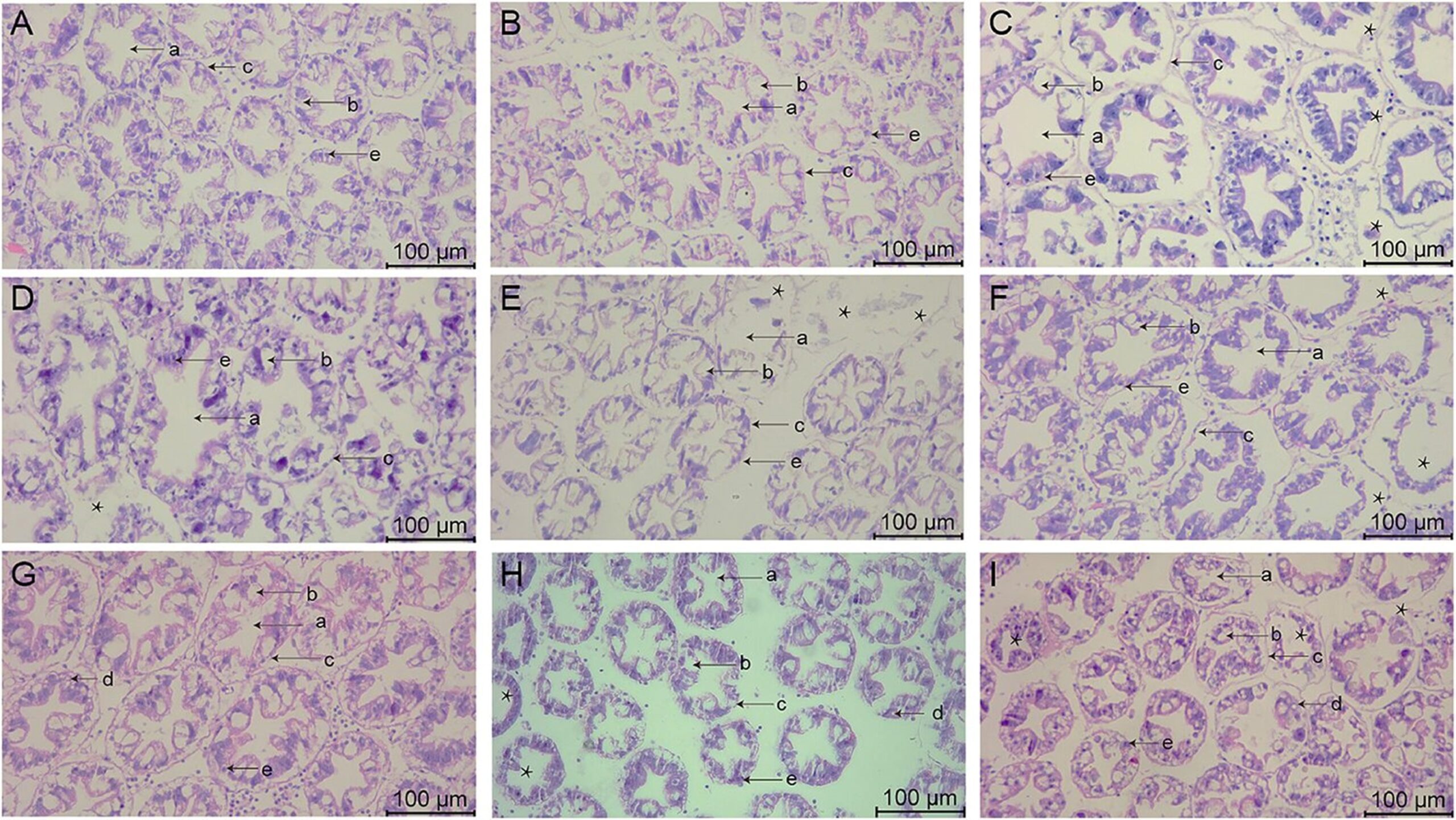 Investigating the effects of ammonia, nitrite and sulfide on Pacific white shrimp juveniles Fig. 2: Hepatopancreatic tissue changes in L. vannamei after 132 h of exposure (200× magnification). (A) Group A1 (10 mg/L ammonia-N); (B) Group A2 (20 mg/L ammonia-N); (C) Group A3 (30 mg/L ammonia-N); (D) Group Y1 (20 mg/L nitrite-N); (E) Group Y2 (40 mg/L nitrite-N); (F) Group Y3 (60 mg/L nitrite-N); (G) Group S1 (2 mg/L sulfide); (H) Group S2 (3mg/L sulfide); (I) Group S3 (4mg/L sulfide). (a) Lumen of hepatopancreatic tubule; (b) B-cells secretory cell; (c) Basement membrane; (d) Restzellen cells; (e) E-cells embryonic cell. Asterisks indicate vacuolization and shrinkage.
