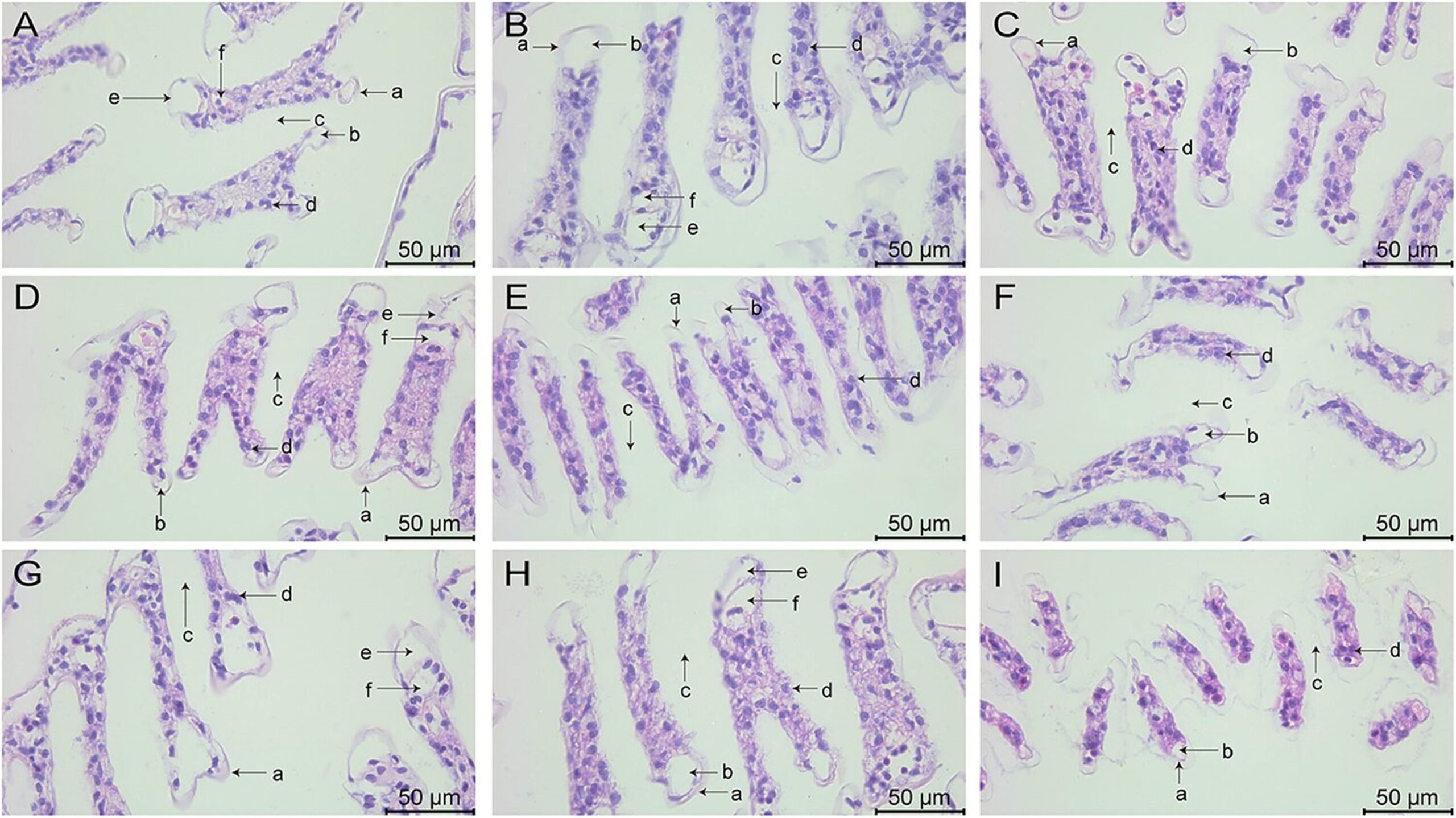 Investigating the effects of ammonia, nitrite and sulfide on Pacific white shrimp juveniles Fig. 4: Gill tissue changes in L. vannamei after 132 h of exposure (400× magnification). (A) Group A1 (10 mg/L ammonia-N); (B) Group A2 (20 mg/L ammonia-N); (C) Group A3 (30 mg/L ammonia-N); (D) Group Y1 (20 mg/L nitrite-N); (E) Group Y2 (40 mg/L nitrite-N); (F) Group Y3 (60 mg/L nitrite-N); (G) Group S1 (2 mg/L sulfide); (H) Group S2 (3mg/L sulfide); (I) Group S3 (4mg/L sulfide). (a) Cuticle; (b) Epithelial cells; (c) Diaphragm; (d) Blood cells; (e) entering gill vessels; (f) exiting gill vessels.
