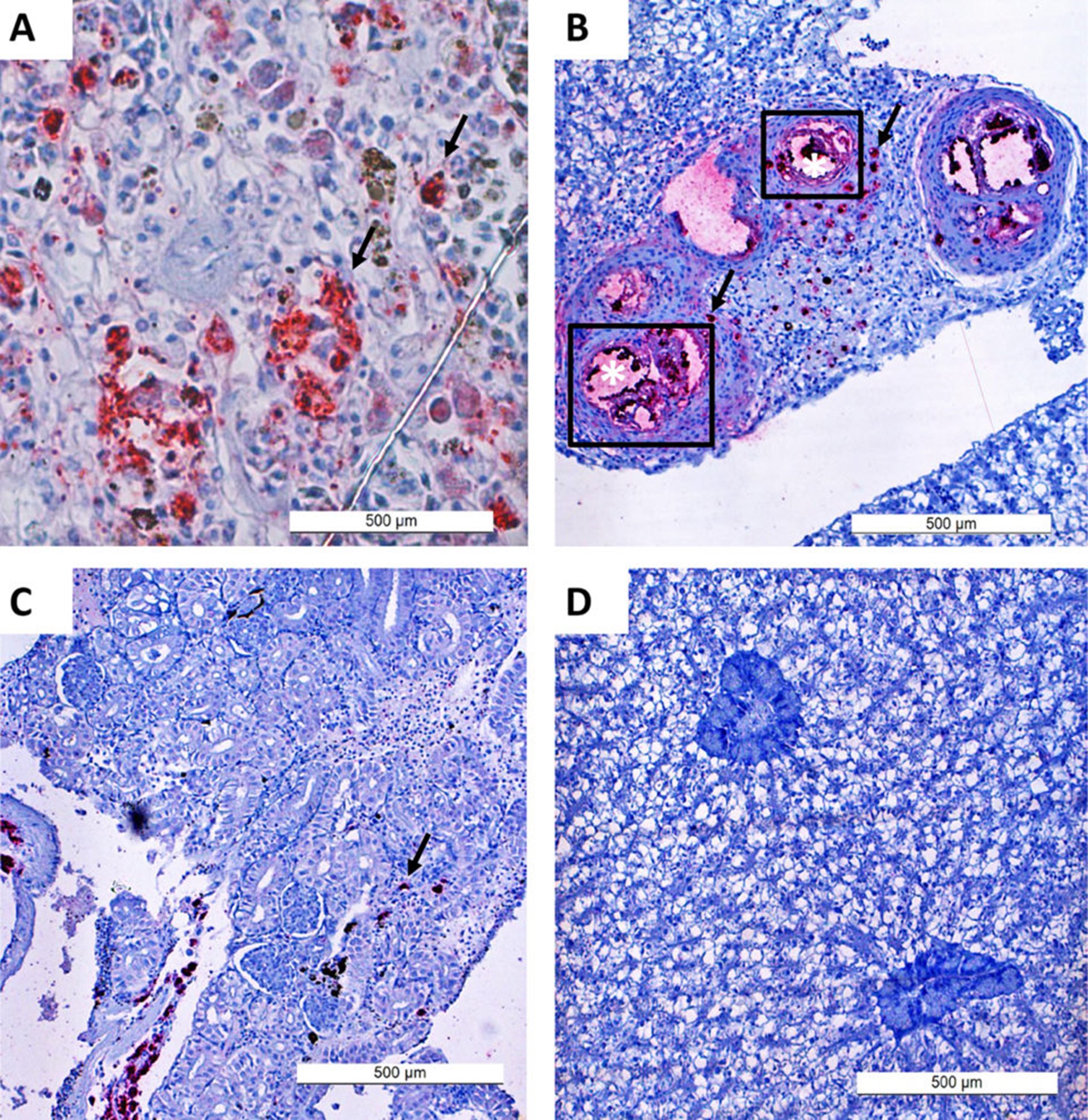 Hình 2: Nhuộm miễn dịch mô học vi khuẩn L. garvieae trong các mô khác nhau của cá rô phi sau khi tiêm phúc mạc. Kháng nguyên vi khuẩn được quan sát thấy dưới dạng vết đỏ (mũi tên) trong lá lách (A), gan tụy (B) và thận (C). Trong gan (B), vi khuẩn tập trung trong và xung quanh các mạch máu, có khả năng là đường xâm nhập. Hình D là từ gan của nhóm đối chứng âm tính và không cho thấy vết nhuộm dương tính.