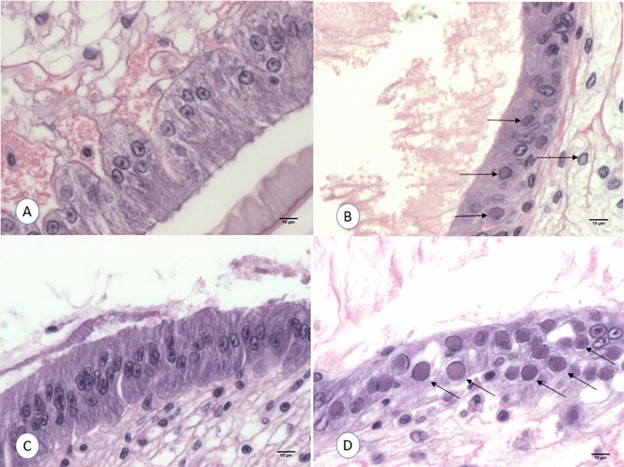 Hình 3: Mô bệnh học H&E của tôm L. vannamei bị nhiễm WSSV trong thí nghiệm sau khi luộc. A: Tôm được cho ăn mô dương tính với WSSV đã luộc trong 1 phút. B: Tôm được cho ăn mô dương tính với WSSV mà không luộc (0 phút, đối chứng dương); C: Tôm được cho ăn mô dương tính với WSSV đã luộc trong 1 phút và đông lạnh trong 2 tuần; D: Tôm được cho ăn mô dương tính với WSSV mà không luộc (0 phút) và đông lạnh trong 2 tuần (đối chứng dương).