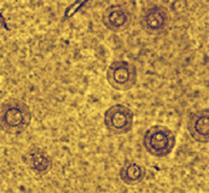 Mẫu vật soi tươi được phóng đại này cho thấy sự nhiễm ký sinh trùng Trichodina trên mô vây đuôi cá rô phi.